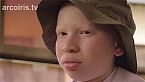 Albinos en África, en grave peligro