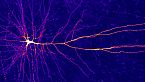 Che cos'è l'Epigenetica? (può cambiare la tua vita?)