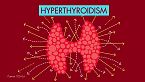 La que pueden liar las hormonas: el hipotiroidismo e hipertiroidismo