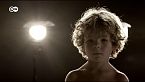 Circuncisión infantil. ¿Una intervención necesaria?